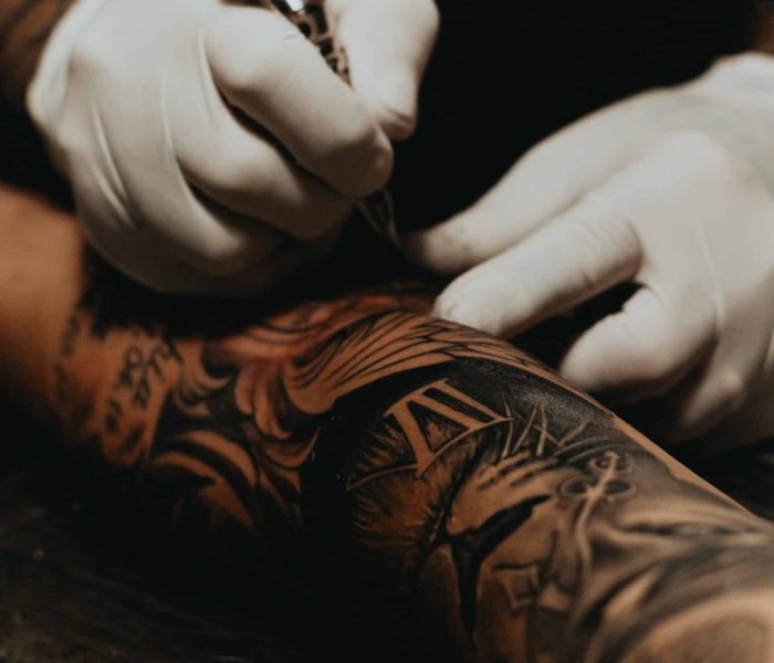Tattoo Removal San Diego | Laser Tattoo Removal Carlsbad Dermacare Medical  Spa